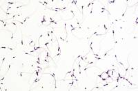 Spermatozoïdes humains x100